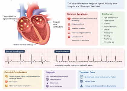 ICD 10 code for AFib unspecified