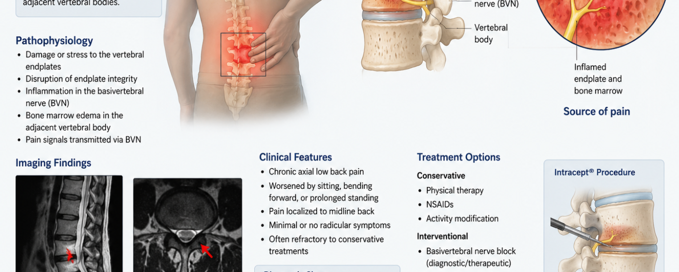 vertebrogenic low back pain